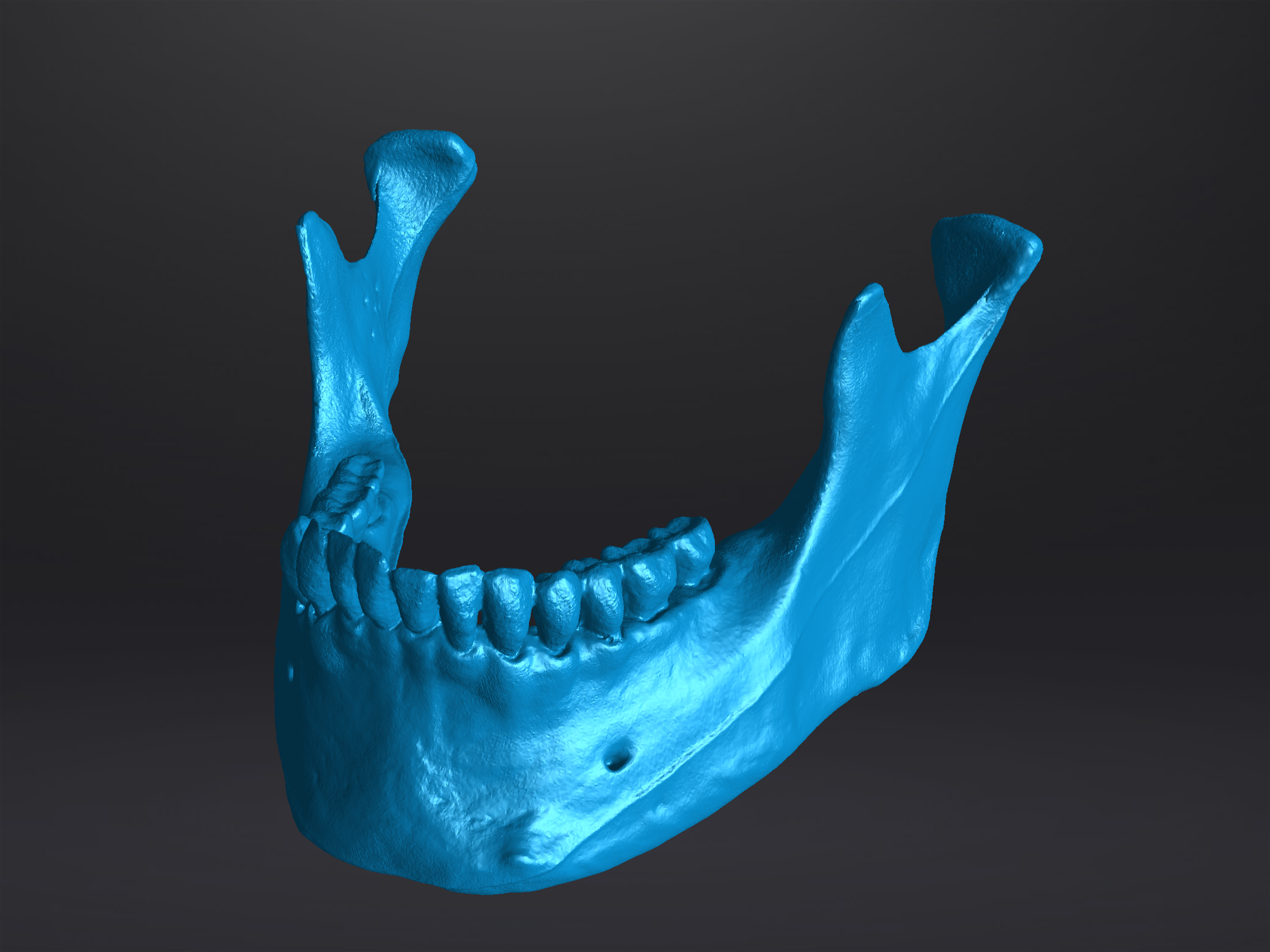 3D Scan